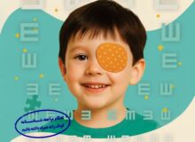 ۳۰ هزار کودک مورد غربالگری بینایی قرار گرفتند